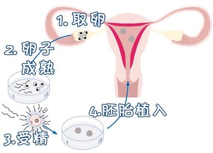 捐卵供卵咨询